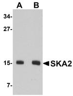 SKA2 Polyclonal Antibody