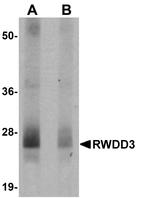 RWDD3 Polyclonal Antibody