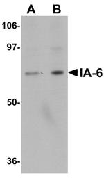 IA-6 Polyclonal Antibody