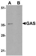 PAGR1 Polyclonal Antibody