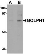 ACBD3 Polyclonal Antibody