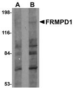 FRMPD1 Antibody in Western Blot (WB)