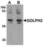 GOLPH2 Antibody in Western Blot (WB)