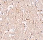FRMPD3 Polyclonal Antibody