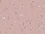 SRPX Polyclonal Antibody