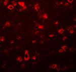 FAM59B Polyclonal Antibody