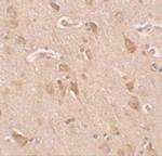 FAM59B Antibody in Immunohistochemistry (IHC)