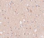 SIPA1L2 Polyclonal Antibody