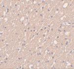 SIPA1L3 Antibody in Immunohistochemistry (IHC)