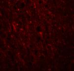 PLEKHM2 Polyclonal Antibody