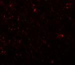 PLEKHM3 Antibody in Immunohistochemistry (IHC)