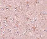 PLEKHM3 Polyclonal Antibody