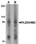 PLEKHM3 Antibody in Western Blot (WB)