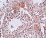 CLPH Polyclonal Antibody
