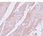CCDC47 Polyclonal Antibody