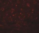 CCDC47 Antibody in Immunohistochemistry (IHC)