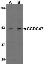CCDC47 Antibody in Western Blot (WB)