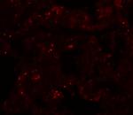 PLEKHM1 Antibody in Immunohistochemistry (IHC)