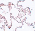 PLEKHM1 Polyclonal Antibody