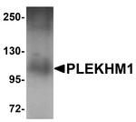 PLEKHM1 Antibody in Western Blot (WB)