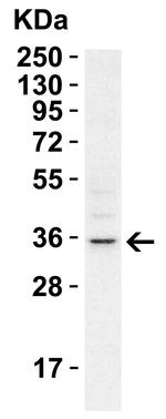 RHBDD1 Polyclonal Antibody