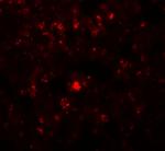 RHBDD2 Polyclonal Antibody