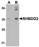RHBDD2 Antibody in Western Blot (WB)
