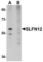 SLFN12 Polyclonal Antibody