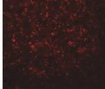 SLFN14 Polyclonal Antibody