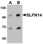 SLFN14 Antibody in Western Blot (WB)