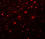 Girdin Polyclonal Antibody