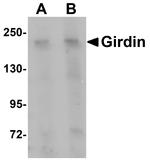 Girdin Antibody in Western Blot (WB)