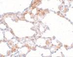 MRE11 Polyclonal Antibody