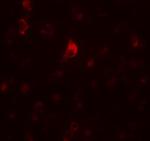 CALM Polyclonal Antibody