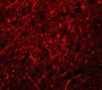 PRDM16 Polyclonal Antibody