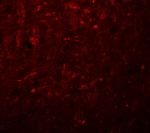 KCNK18 Polyclonal Antibody