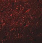 SYNGR2 Antibody in Immunohistochemistry (IHC)