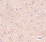 SYNGR2 Polyclonal Antibody