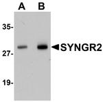 SYNGR2 Antibody in Western Blot (WB)