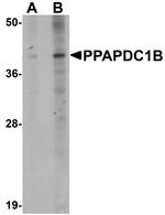 PPAPDC1B Polyclonal Antibody