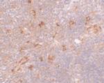 NAT11 Polyclonal Antibody