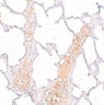 REEP2 Polyclonal Antibody