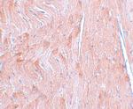 REEP3 Antibody in Immunohistochemistry (IHC)
