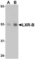 LXR beta Polyclonal Antibody