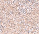 Nanog Antibody in Immunohistochemistry (IHC)