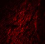 GATA3 Antibody in Immunohistochemistry (IHC)