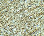 GATA3 Polyclonal Antibody