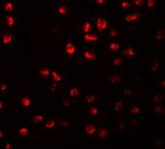 ARHGAP18 Antibody in Immunocytochemistry (ICC/IF)