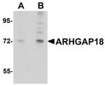 ARHGAP18 Antibody in Western Blot (WB)