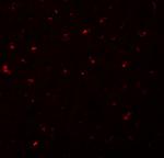 CALHM1 Polyclonal Antibody